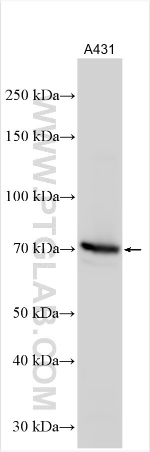 Western Blot (WB) analysis of various lysates using GSTCD Polyclonal antibody (17502-1-AP)