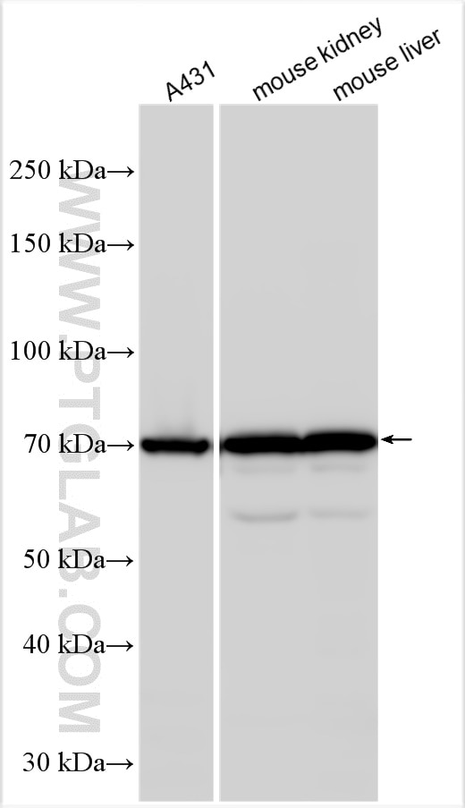 Western Blot (WB) analysis of various lysates using GSTCD Polyclonal antibody (17502-1-AP)