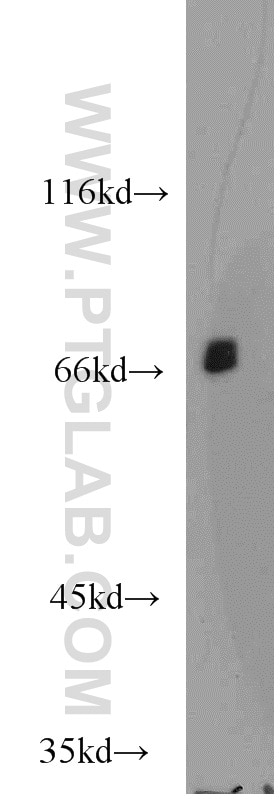 Western Blot (WB) analysis of L02 cells using GSTCD Polyclonal antibody (17502-1-AP)