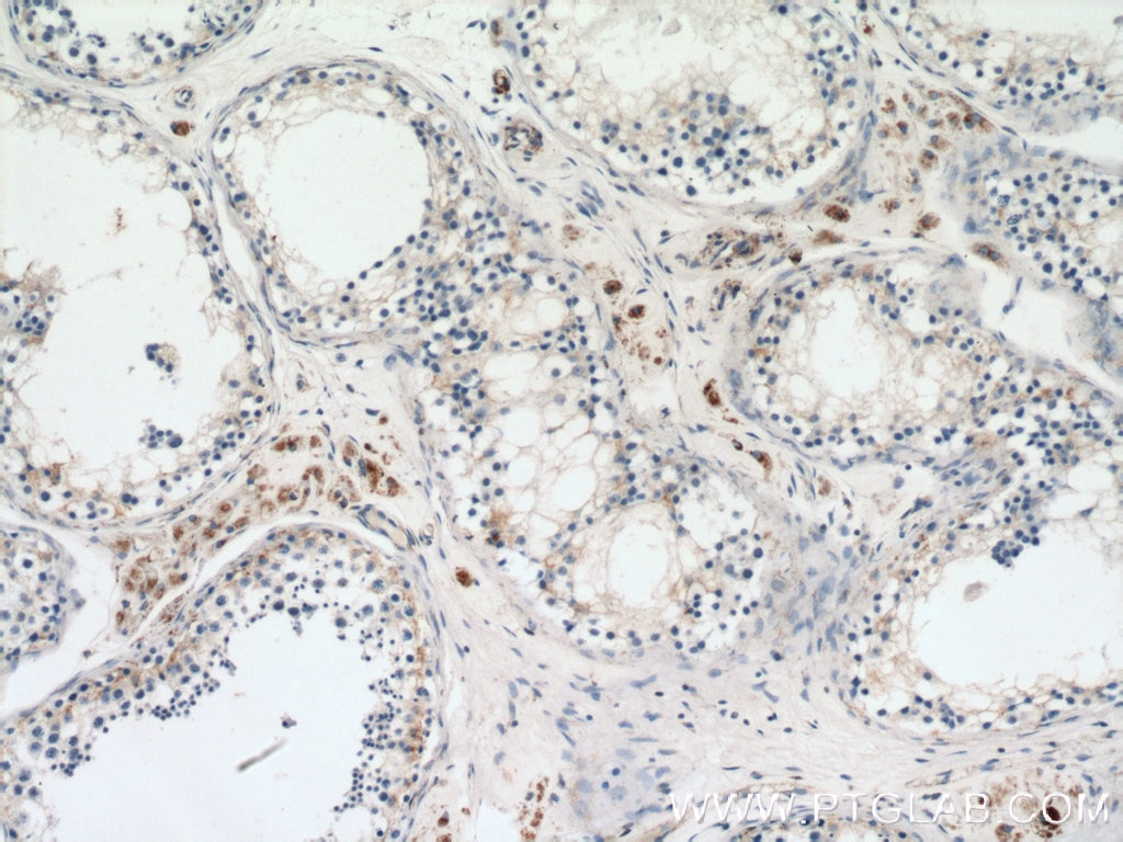 Immunohistochemistry (IHC) staining of human testis tissue using GSTK1 Polyclonal antibody (14535-1-AP)