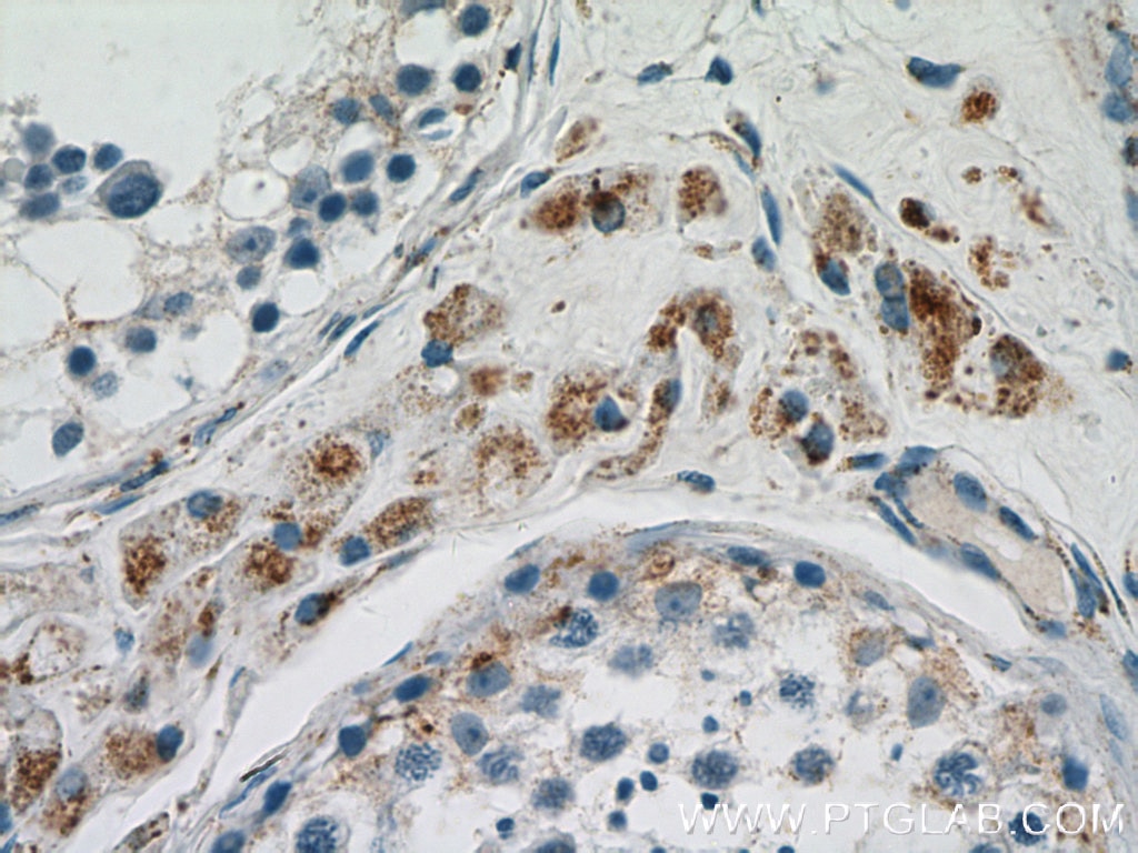 Immunohistochemistry (IHC) staining of human testis tissue using GSTK1 Polyclonal antibody (14535-1-AP)