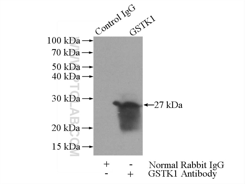 Immunoprecipitation (IP) experiment of Raji cells using GSTK1 Polyclonal antibody (14535-1-AP)
