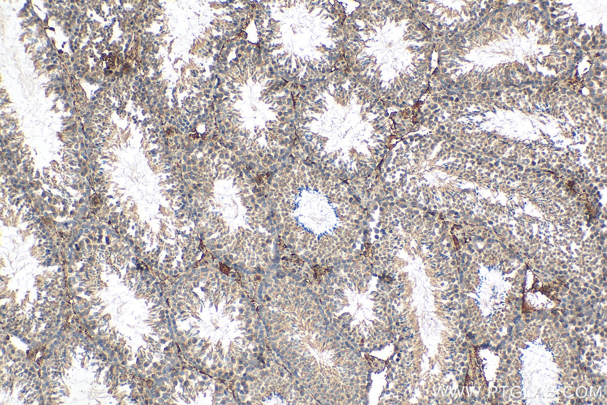 Immunohistochemistry (IHC) staining of mouse testis tissue using GSTK1 Recombinant antibody (81527-1-RR)