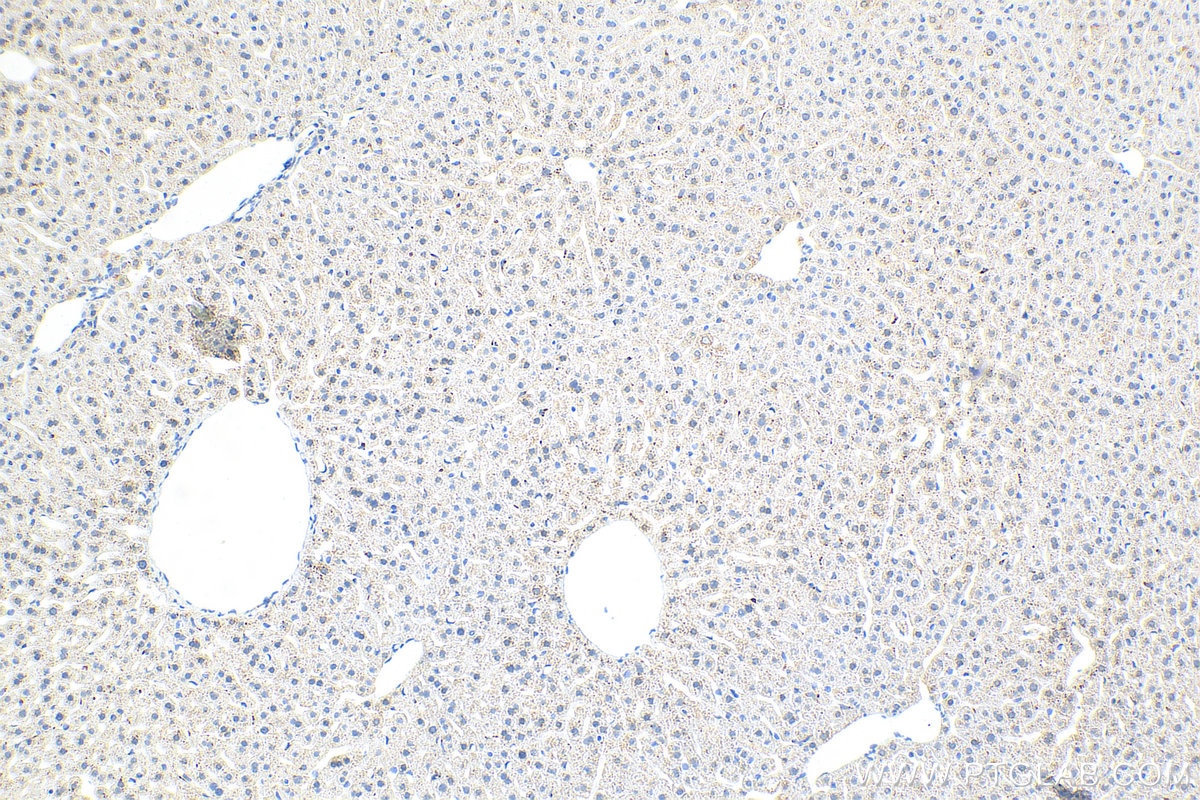 Immunohistochemistry (IHC) staining of mouse liver tissue using GSTK1 Recombinant antibody (81527-1-RR)