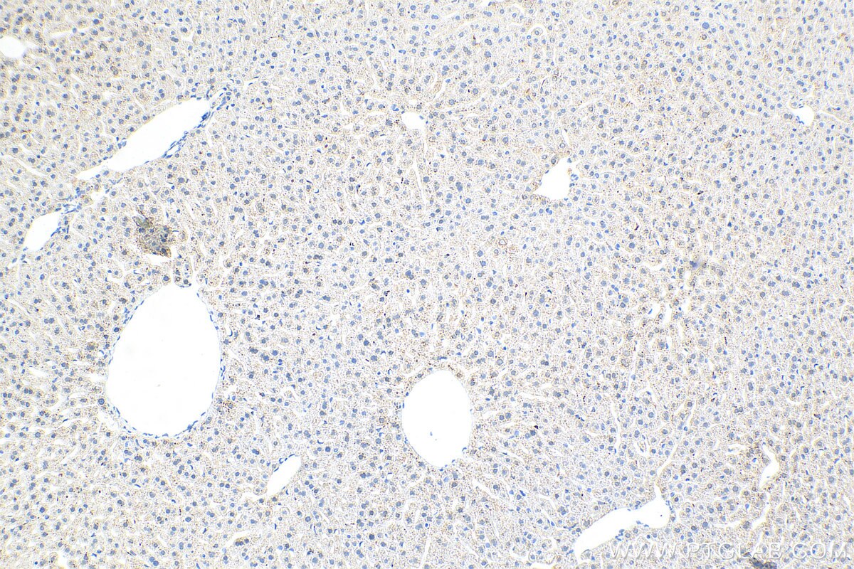 Immunohistochemistry (IHC) staining of mouse liver tissue using GSTK1 Recombinant antibody (81527-1-RR)