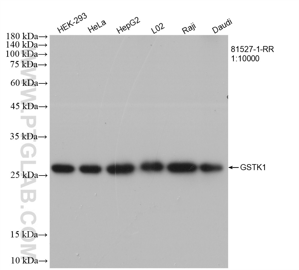 Western Blot (WB) analysis of various lysates using GSTK1 Recombinant antibody (81527-1-RR)