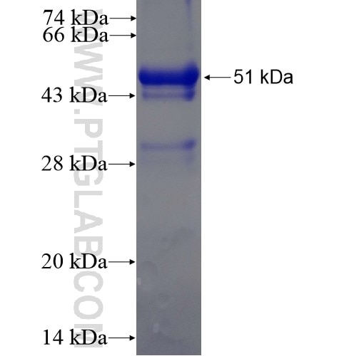 GSTK1 fusion protein Ag6036 SDS-PAGE