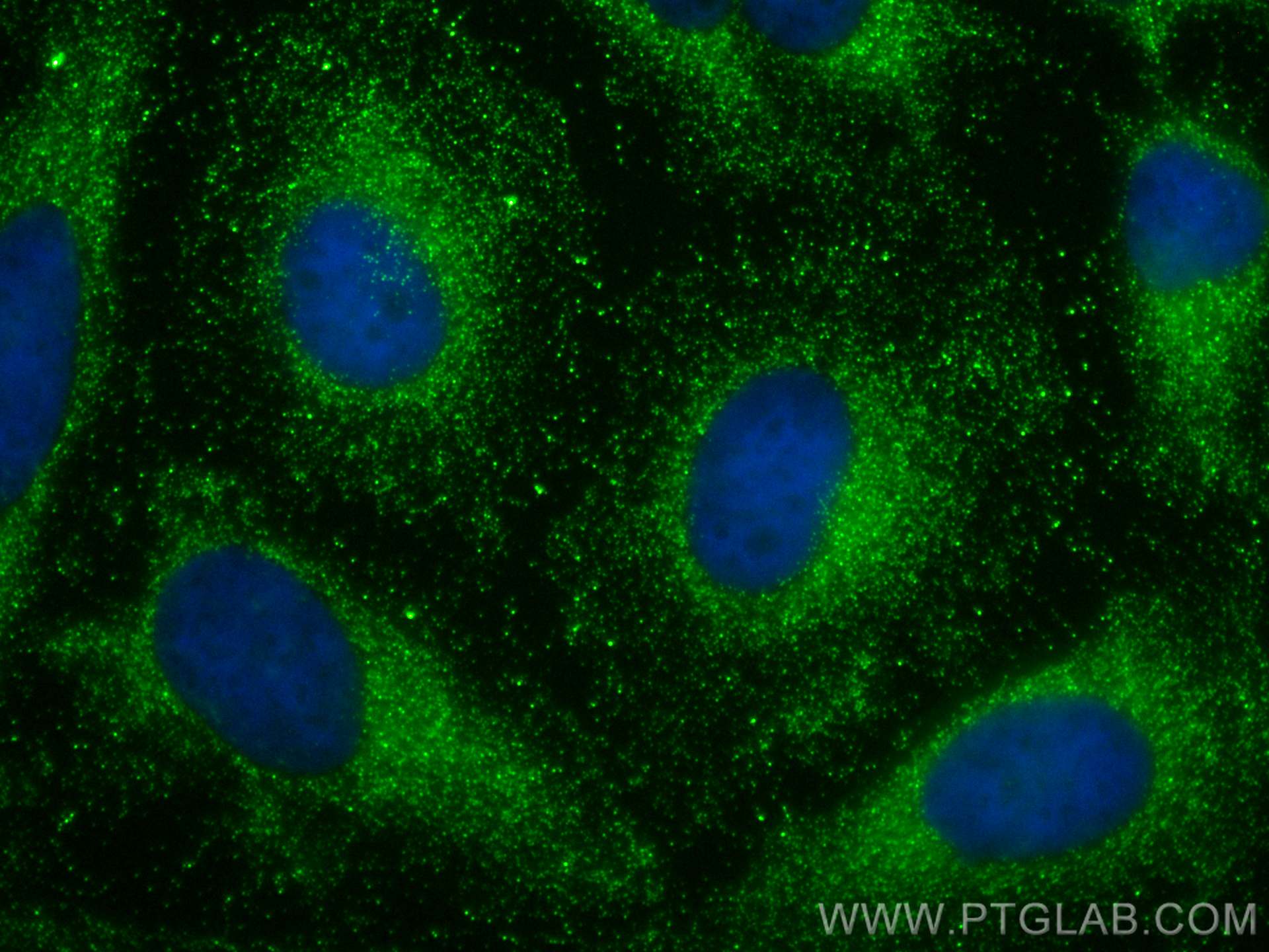 Immunofluorescence (IF) / fluorescent staining of HeLa cells using GSTM1 Polyclonal antibody (12412-1-AP)