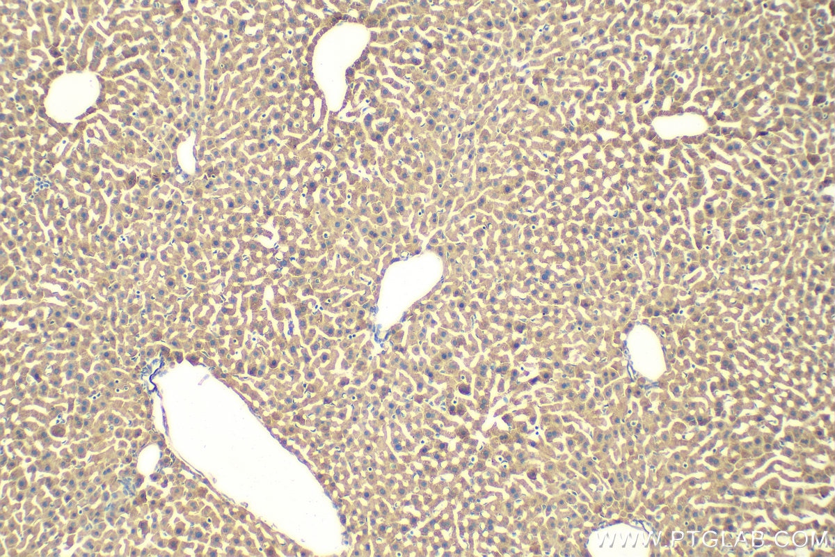Immunohistochemistry (IHC) staining of mouse liver tissue using GSTM1 Polyclonal antibody (12412-1-AP)
