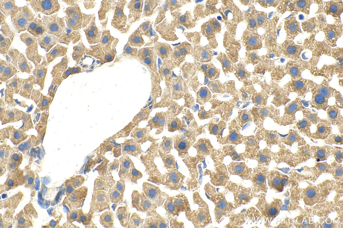 Immunohistochemistry (IHC) staining of mouse liver tissue using GSTM1 Polyclonal antibody (12412-1-AP)