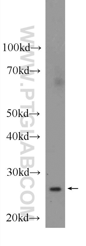 WB analysis of mouse kidney using 12412-1-AP