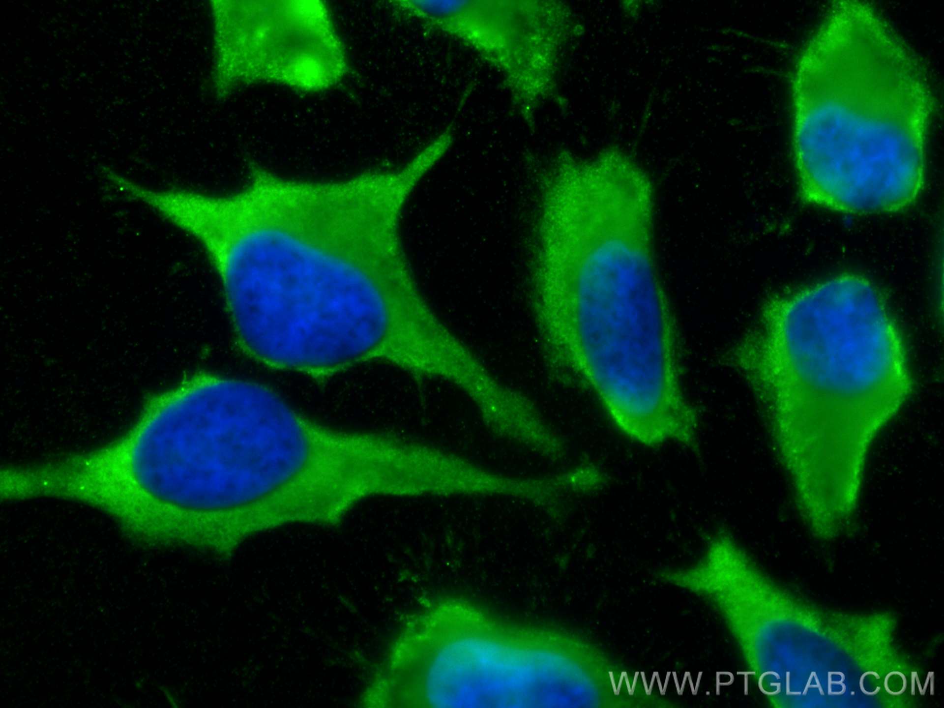 Immunofluorescence (IF) / fluorescent staining of HeLa cells using GSTM2 Polyclonal antibody (55474-1-AP)