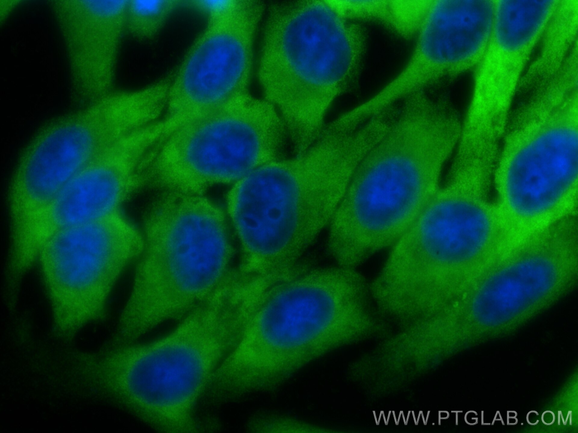Immunofluorescence (IF) / fluorescent staining of HepG2 cells using GSTM3 Polyclonal antibody (15214-1-AP)