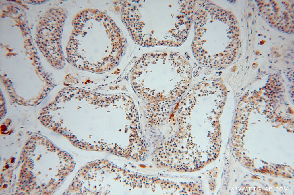 Immunohistochemistry (IHC) staining of human testis tissue using GSTM3 Polyclonal antibody (15214-1-AP)