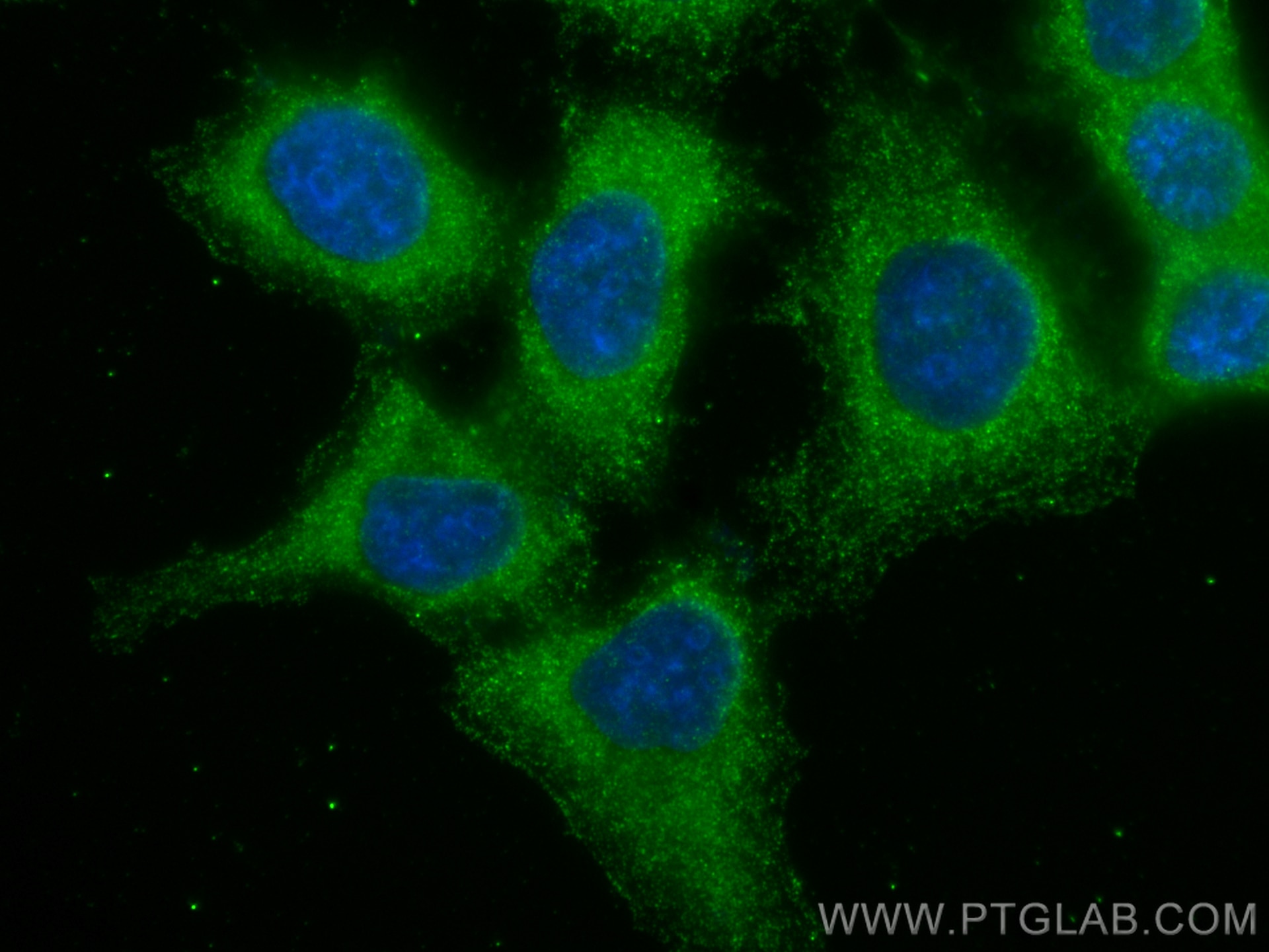 Immunofluorescence (IF) / fluorescent staining of A431 cells using GSTM3 Monoclonal antibody (67634-1-Ig)