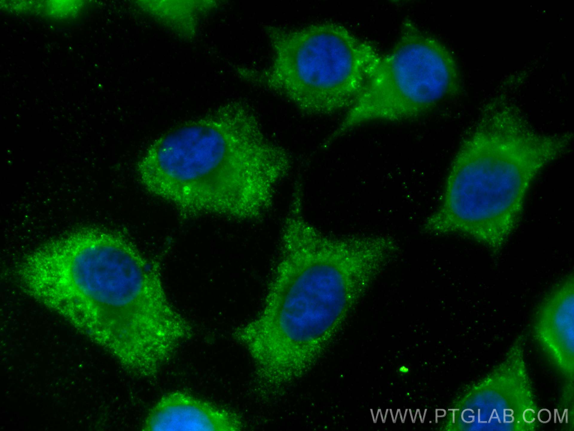 Immunofluorescence (IF) / fluorescent staining of A431 cells using CoraLite® Plus 488-conjugated GSTM3 Monoclonal ant (CL488-67634)