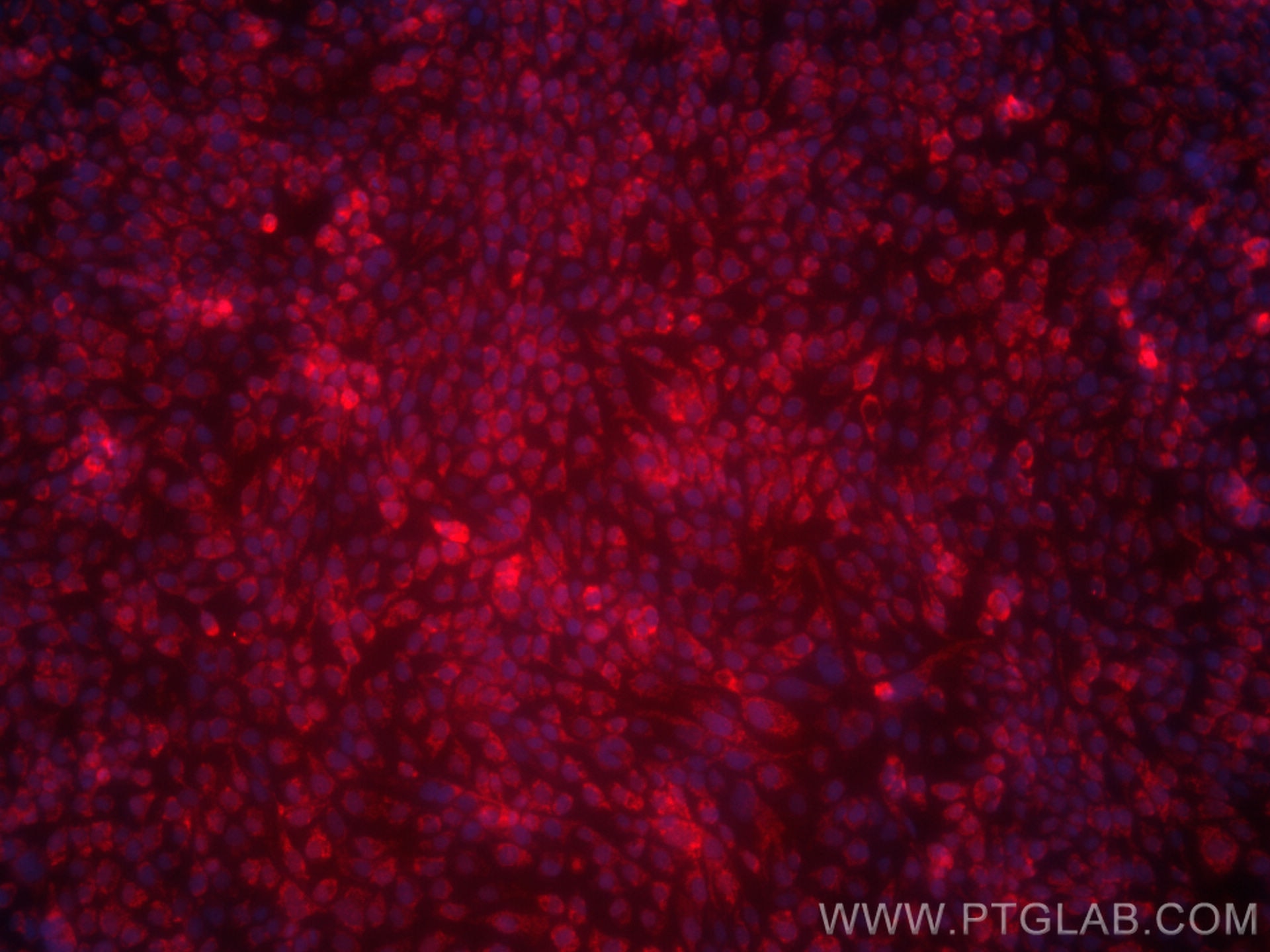 Immunofluorescence (IF) / fluorescent staining of A431 cells using CoraLite®594-conjugated GSTM3 Monoclonal antibody (CL594-67634)