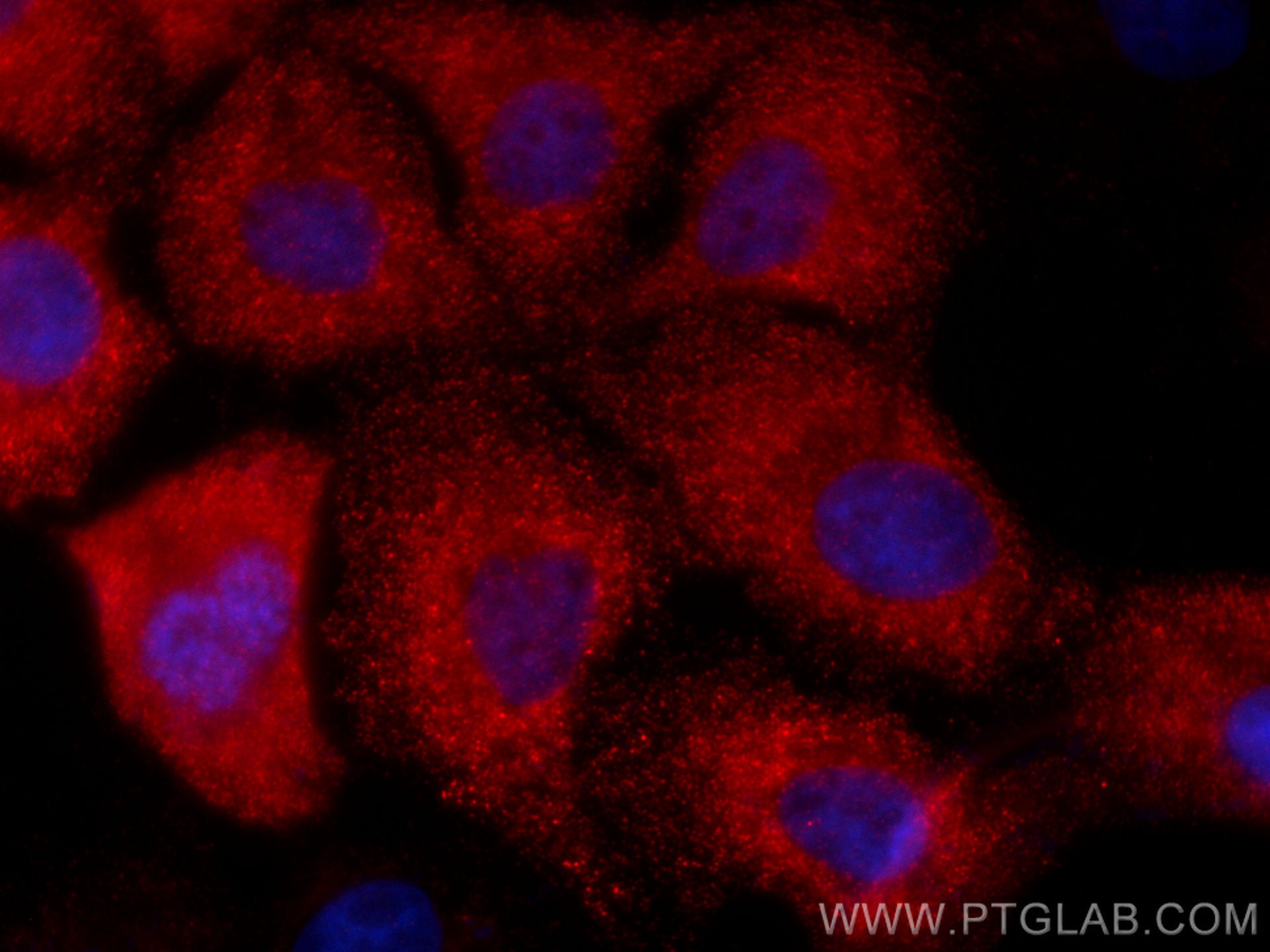 Immunofluorescence (IF) / fluorescent staining of A431 cells using CoraLite®594-conjugated GSTM3 Monoclonal antibody (CL594-67634)