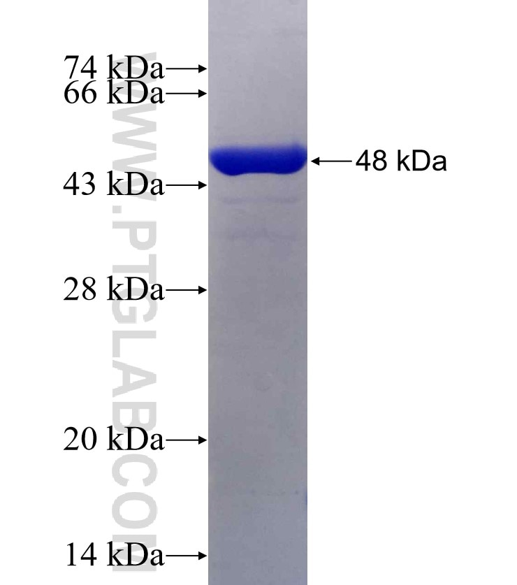 GSTM3 fusion protein Ag7375 SDS-PAGE