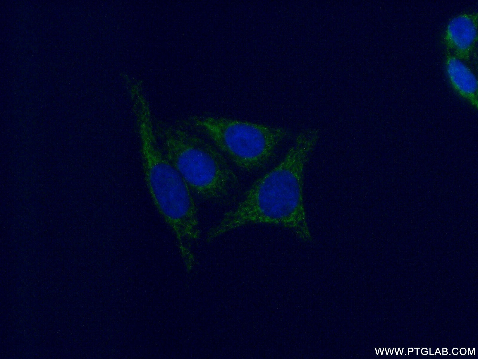 Immunofluorescence (IF) / fluorescent staining of HepG2 cells using GSTM4 Polyclonal antibody (16766-1-AP)
