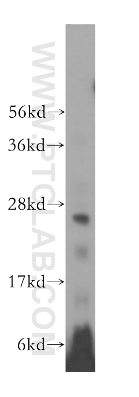 Western Blot (WB) analysis of HeLa cells using GSTM4 Polyclonal antibody (16766-1-AP)