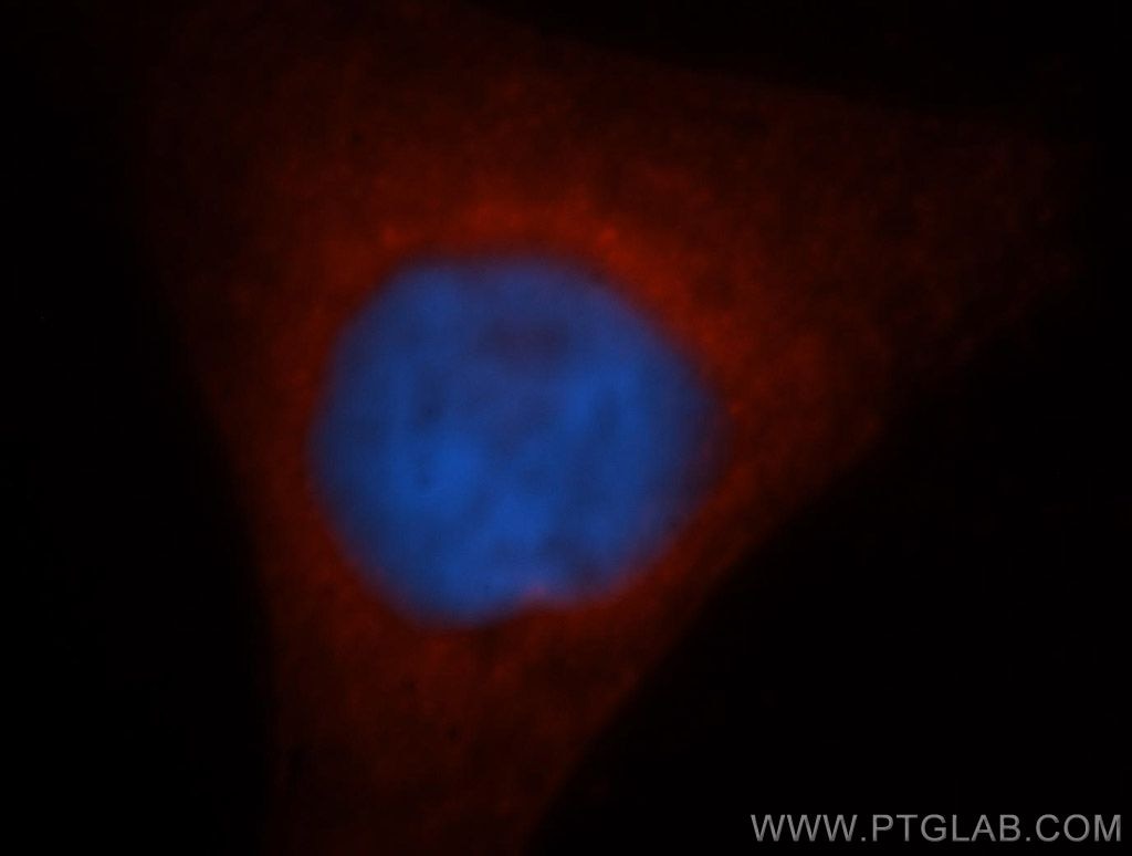 Immunofluorescence (IF) / fluorescent staining of HepG2 cells using GSTM5 Polyclonal antibody (14502-1-AP)