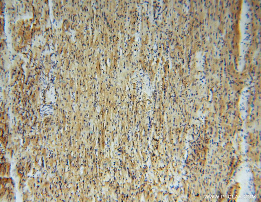 Immunohistochemistry (IHC) staining of human heart tissue using GSTM5 Polyclonal antibody (14502-1-AP)