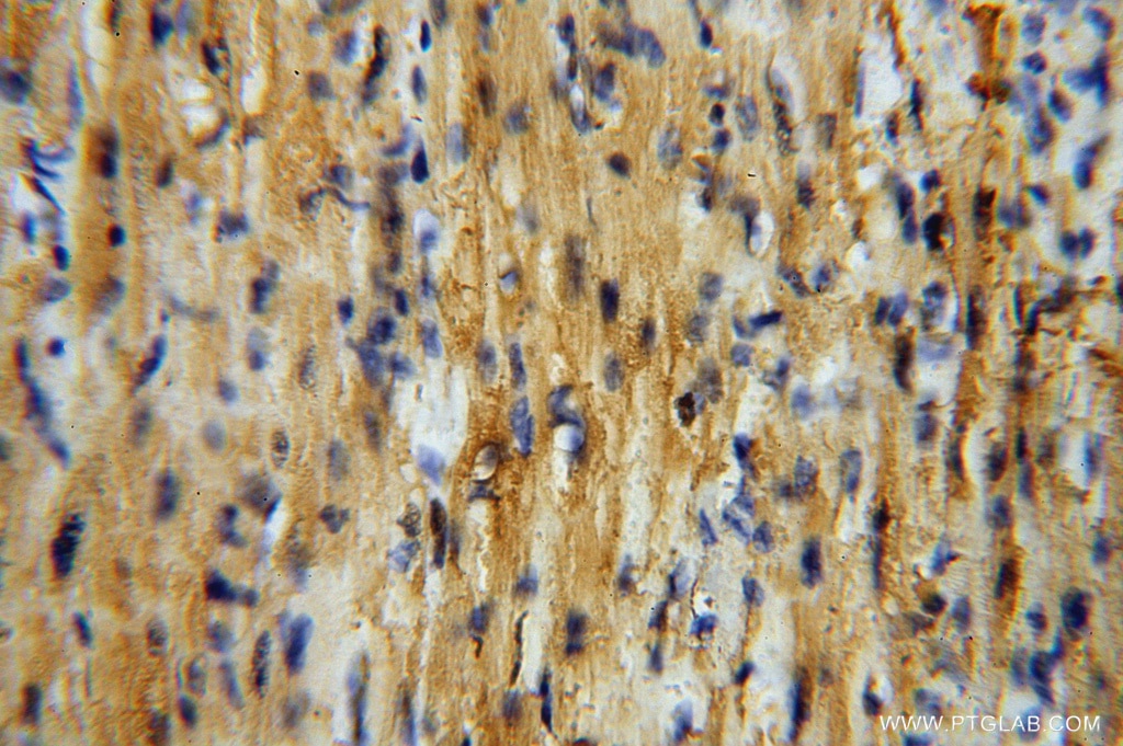 Immunohistochemistry (IHC) staining of human heart tissue using GSTM5 Polyclonal antibody (14502-1-AP)