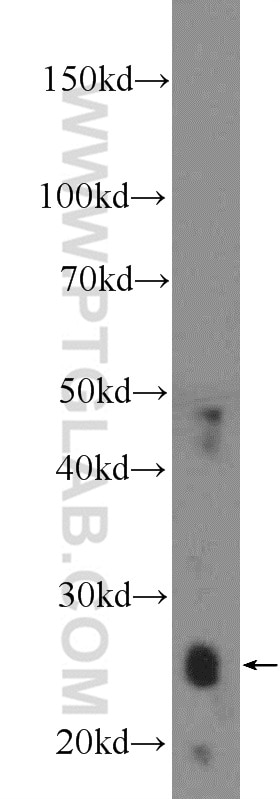 Western Blot (WB) analysis of rat skeletal muscle tissue using GSTM5 Polyclonal antibody (14502-1-AP)