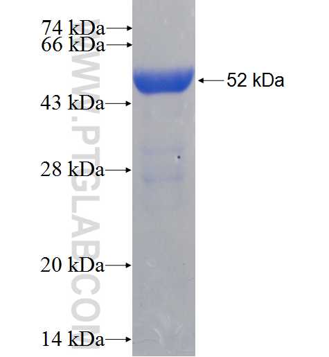 GSTM5 fusion protein Ag5958 SDS-PAGE