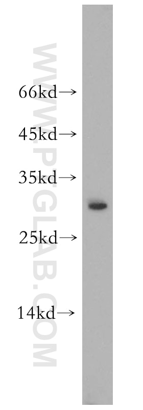 Western Blot (WB) analysis of mouse liver tissue using GSTO1 Polyclonal antibody (15124-1-AP)