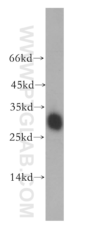 Western Blot (WB) analysis of human heart tissue using GSTO1 Polyclonal antibody (15124-1-AP)