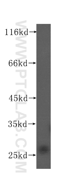 Western Blot (WB) analysis of Jurkat cells using GSTO1 Monoclonal antibody (60150-1-Ig)