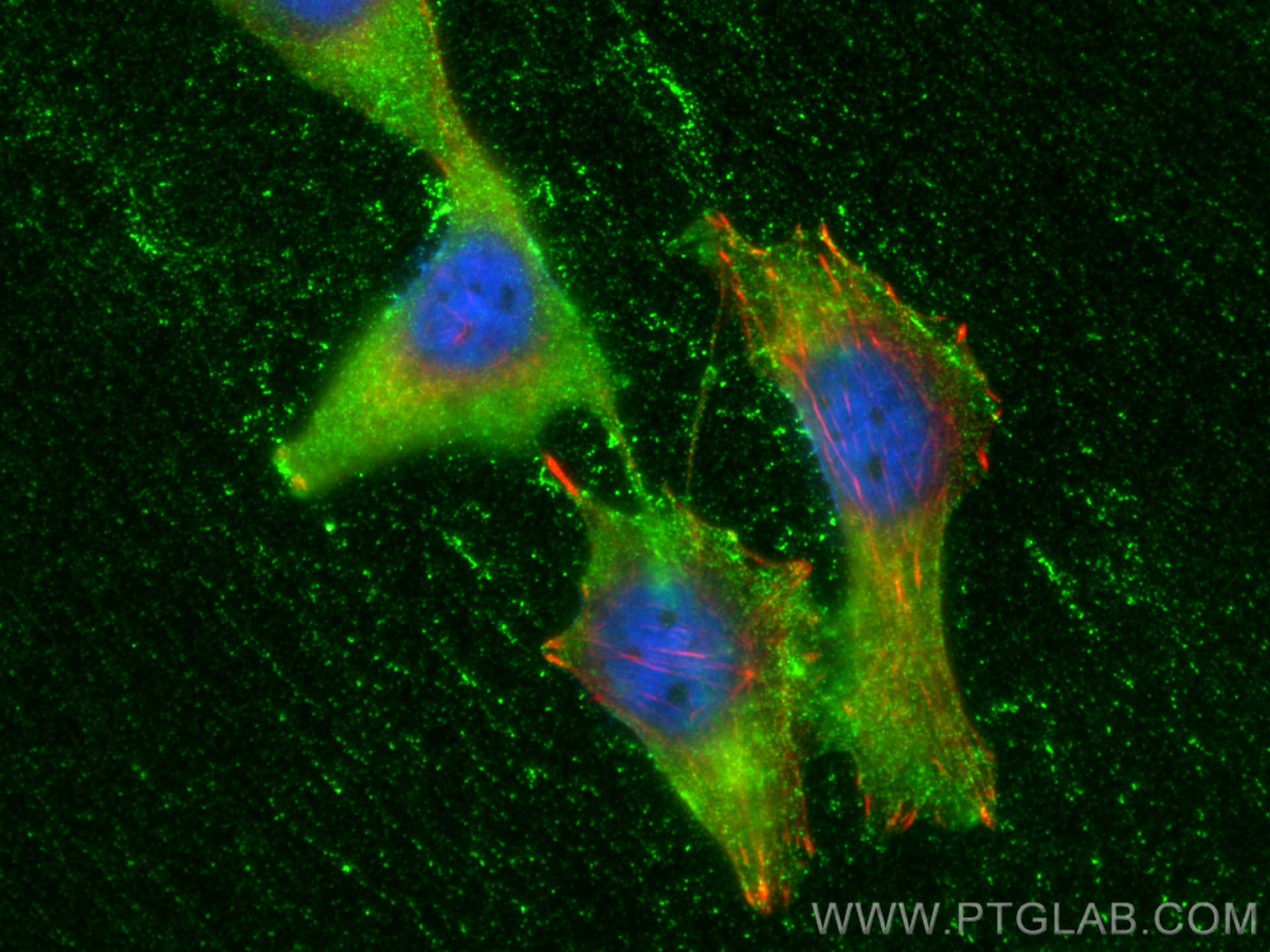 Immunofluorescence (IF) / fluorescent staining of PC-3 cells using GSTO1 Monoclonal antibody (60150-2-Ig)