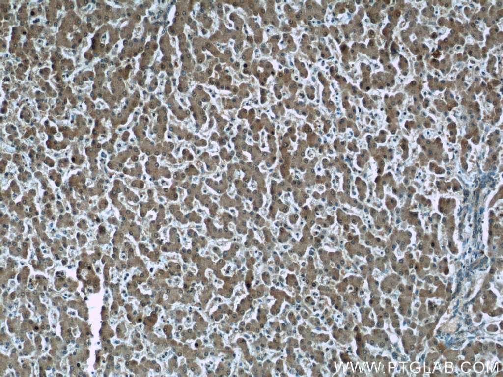 Immunohistochemistry (IHC) staining of human liver tissue using GSTO1 Monoclonal antibody (60150-2-Ig)