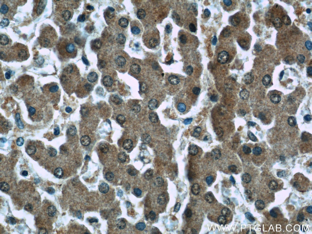 IHC staining of human liver using 60150-2-Ig