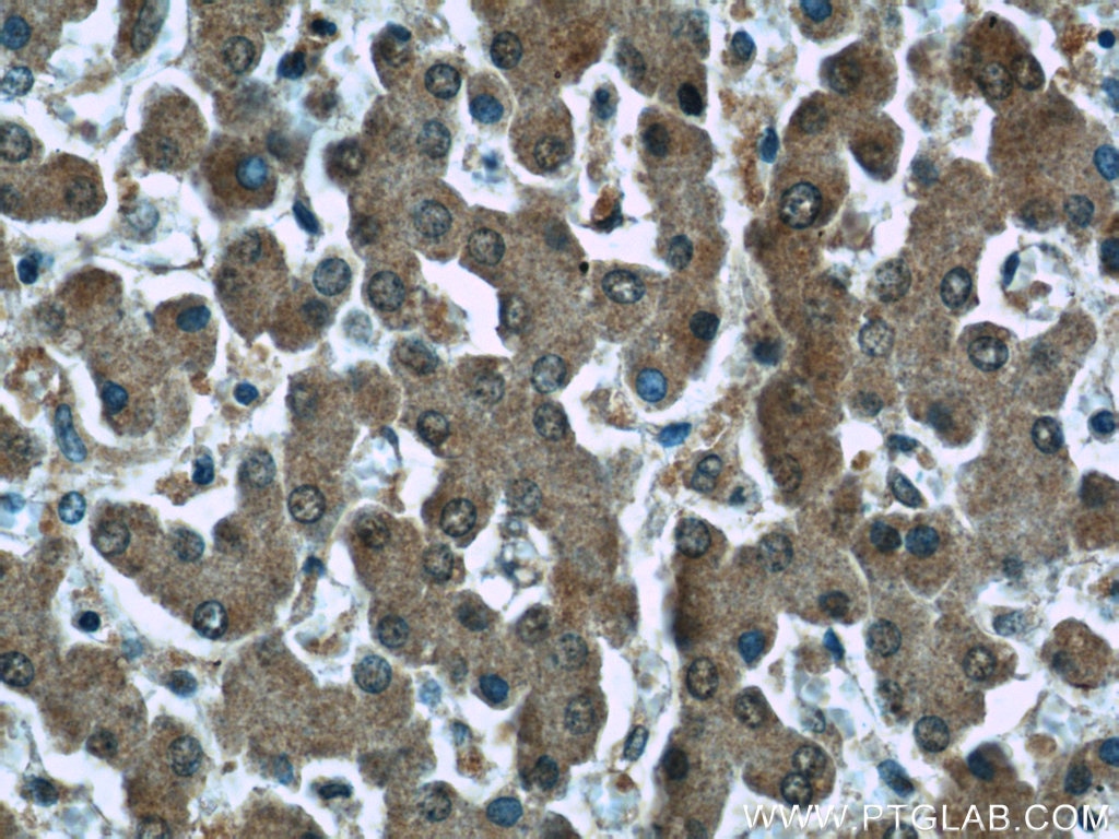 Immunohistochemistry (IHC) staining of human liver tissue using GSTO1 Monoclonal antibody (60150-2-Ig)