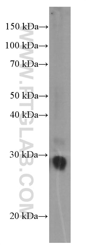 Western Blot (WB) analysis of NIH/3T3 cells using GSTO1 Monoclonal antibody (60150-2-Ig)