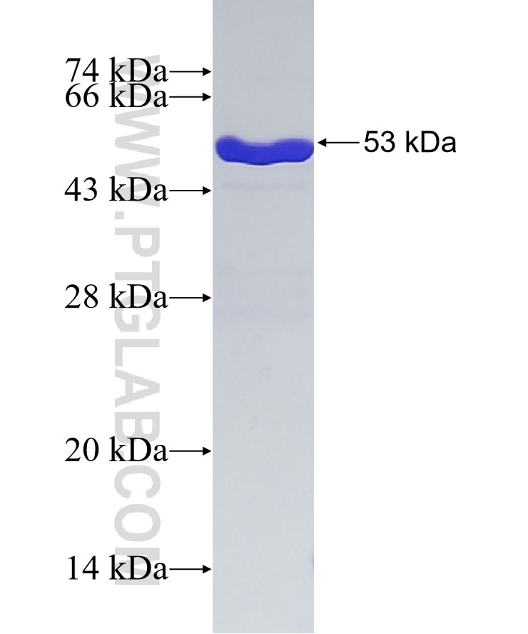 GSTO1 fusion protein Ag7199 SDS-PAGE