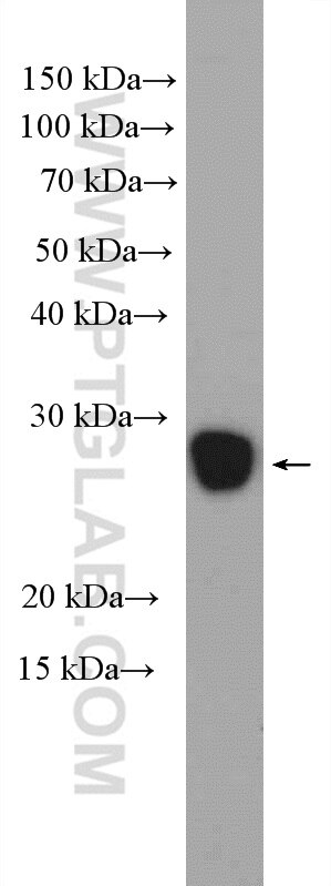 WB analysis of rat testis using 14562-1-AP