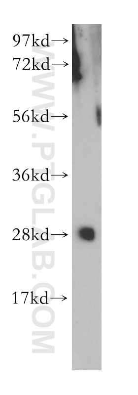 Western Blot (WB) analysis of mouse skeletal muscle tissue using GSTO2 Polyclonal antibody (14562-1-AP)