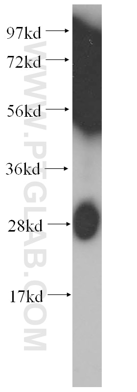 Western Blot (WB) analysis of HeLa cells using GSTO2 Polyclonal antibody (14562-1-AP)