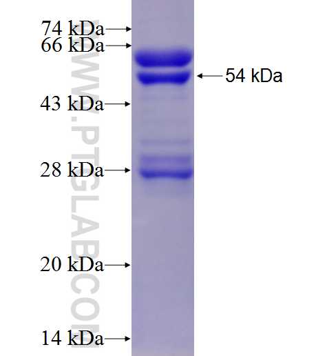 GSTO2 fusion protein Ag6120 SDS-PAGE