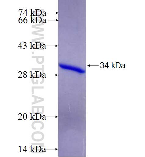 GSTO2 fusion protein Ag6424 SDS-PAGE