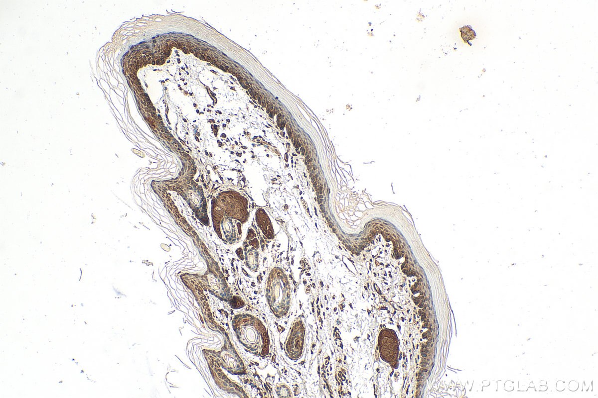 Immunohistochemistry (IHC) staining of mouse skin tissue using GSTP1 Polyclonal antibody (15902-1-AP)