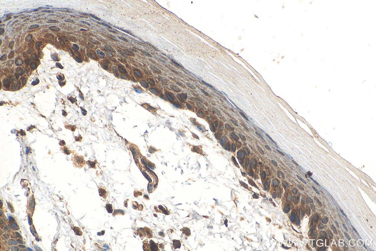 Immunohistochemistry (IHC) staining of mouse skin tissue using GSTP1 Polyclonal antibody (15902-1-AP)