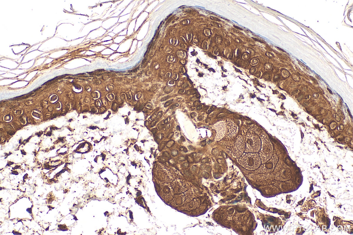 IHC staining of mouse skin using 15902-1-AP Immunohistochemistry (IHC) staining of mouse skin tissue using GSTP1 Polyclonal antibody (15902-1-AP)