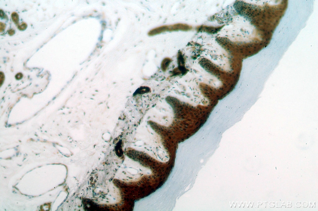 Immunohistochemistry (IHC) staining of human skin tissue using GSTP1 Polyclonal antibody (15902-1-AP)