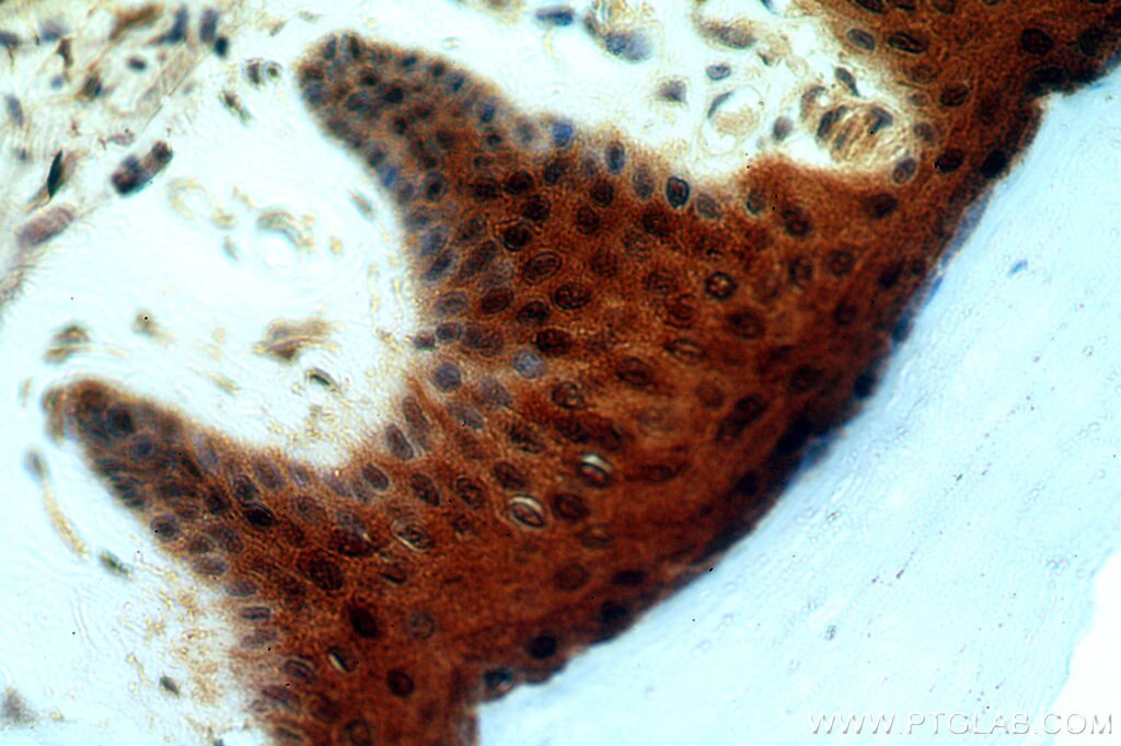 Immunohistochemistry (IHC) staining of human skin tissue using GSTP1 Polyclonal antibody (15902-1-AP)