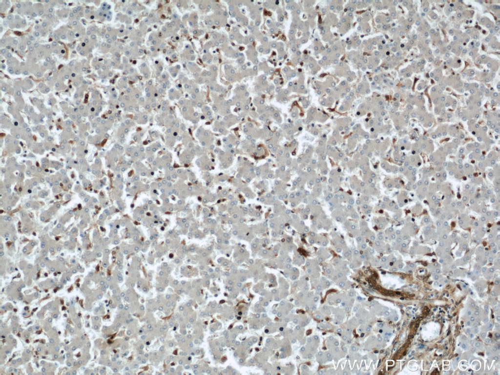 Immunohistochemistry (IHC) staining of human liver tissue using GSTP1 Polyclonal antibody (15902-1-AP)